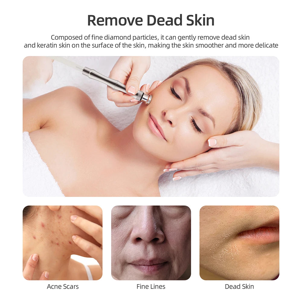 Foreverlily Spa Facial Peeling Deep Cleansing Device Pore Cleaning