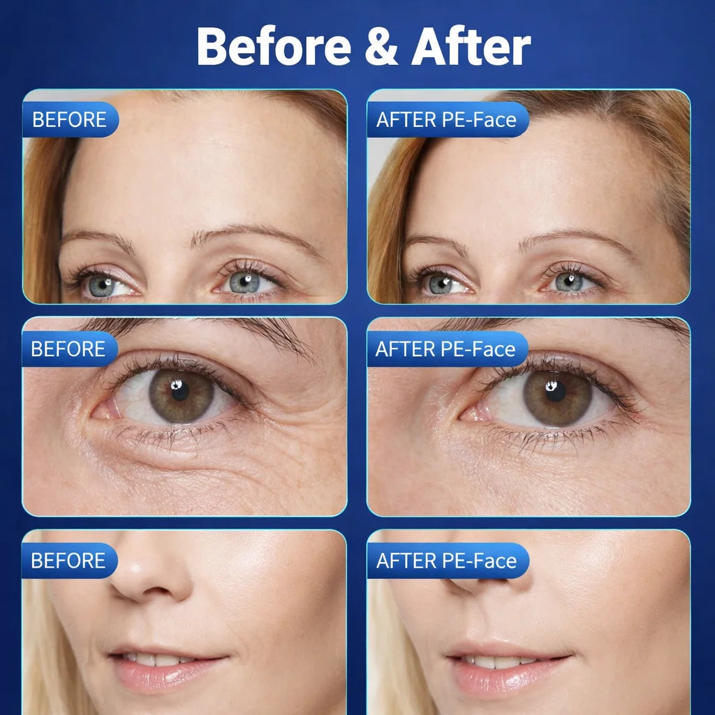 MYOSLIM Face Beauty Device With Temperature, Microcurrent And Electromagnetic Wave
