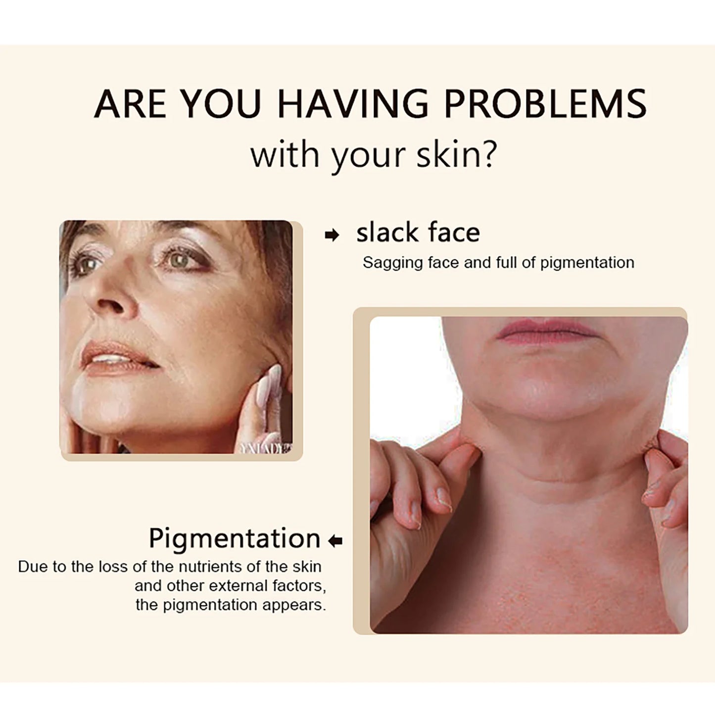 KYLIEFIT Collagen Whitening Cream Brightening Facial And Body Moisturizer