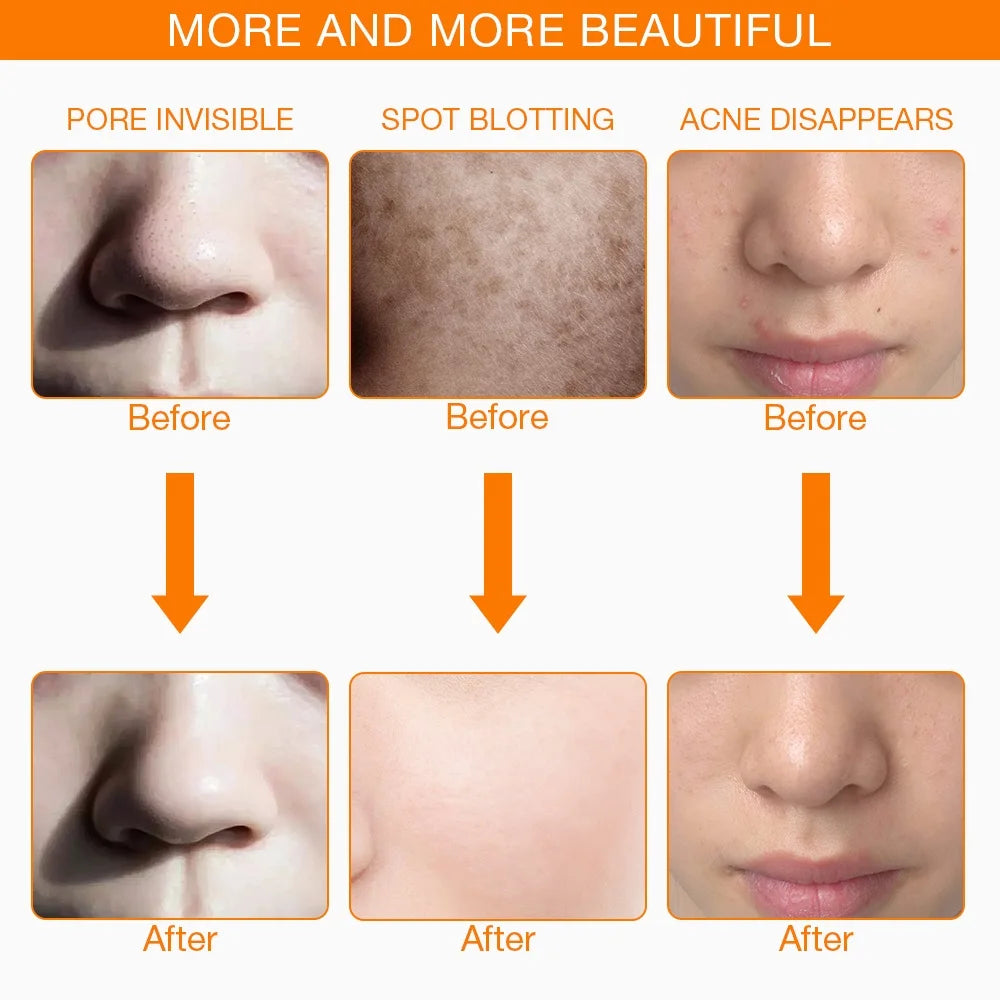 Iebilif LED Facial Mask for Face and Neck Anti Aging Rejuvenation