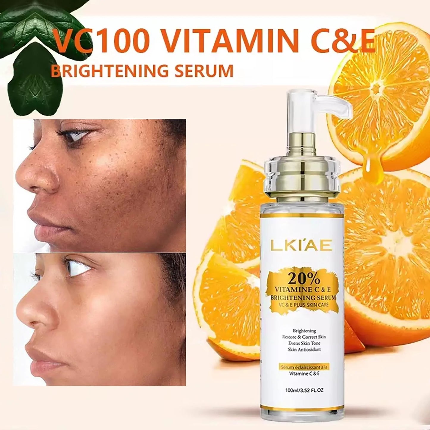 AILKE Vitamin C And E Brightening Serum Reduces Dark Spots
