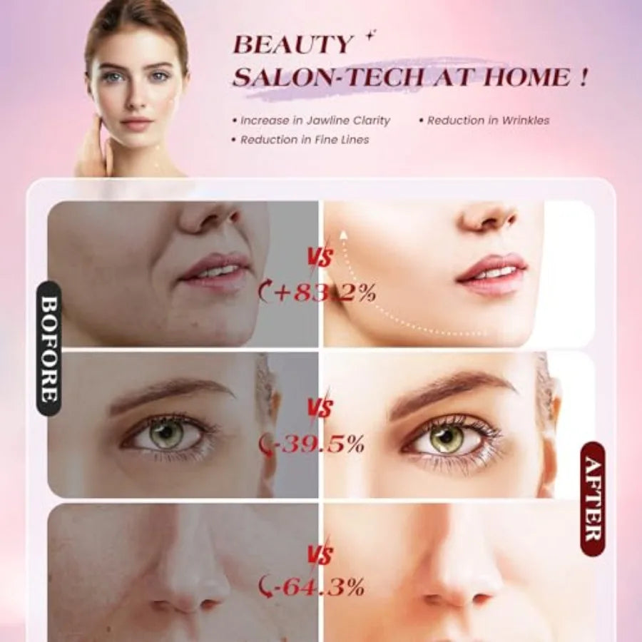 Microcurrent Facial Device Three Modes Red Light Therapy Face Neck