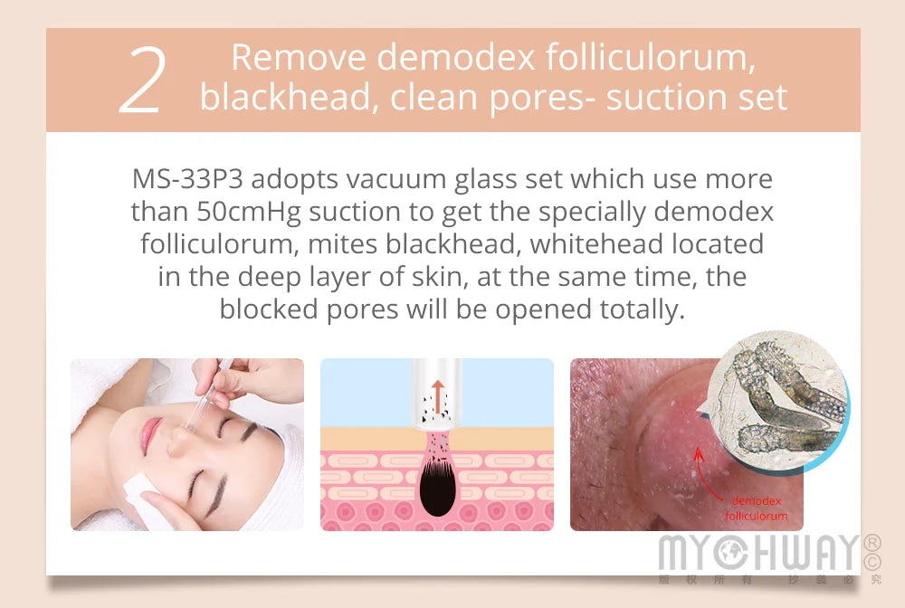 Mychway 3 In 1 Skin Care Ultrasound Dermabrasion Facial Device